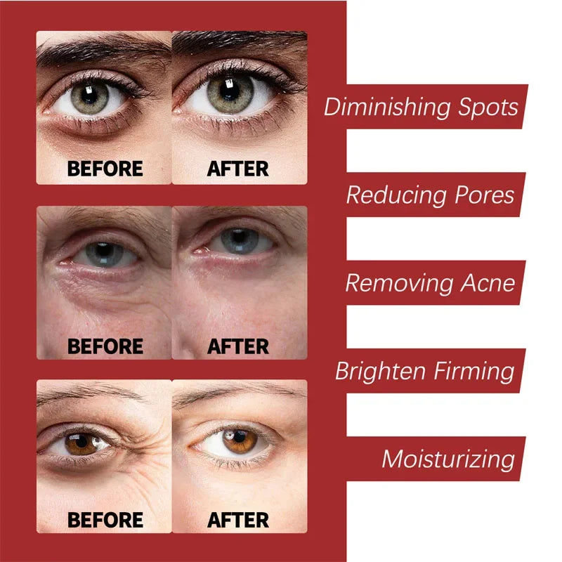 Retinol Wrinkle Removing