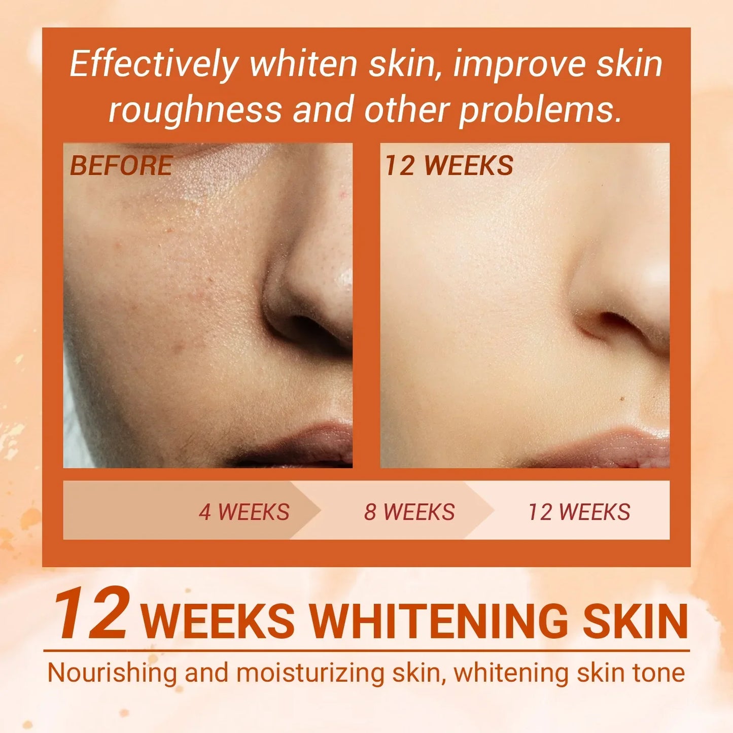 Vitamin C Whitening Freckles Face Serum Remove Dark Spot Fade Melasma Anti-Aging