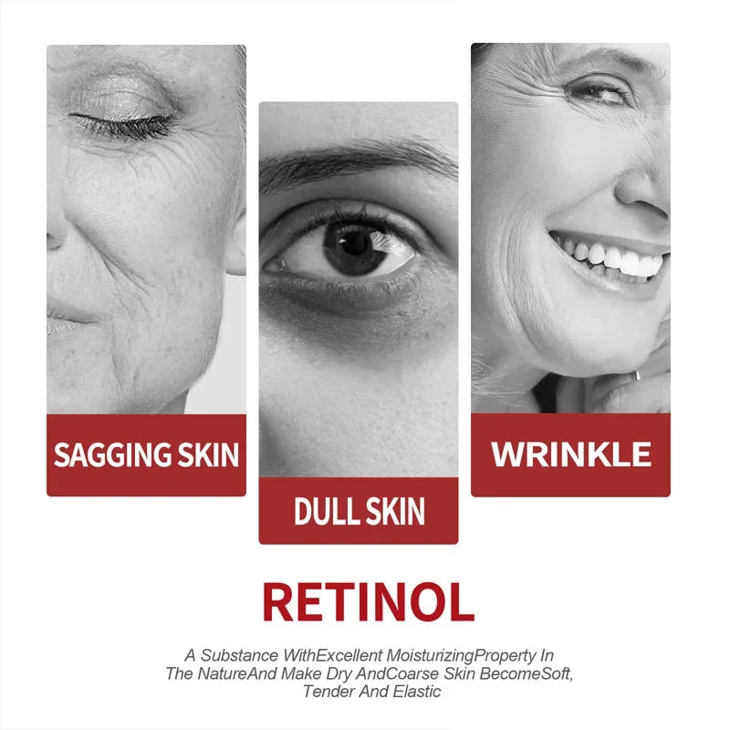 Retinol Wrinkle Removing