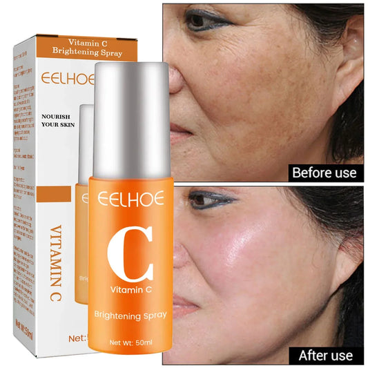 Vitamin C Whitening Freckles Face Serum Remove Dark Spot Fade Melasma Anti-Aging